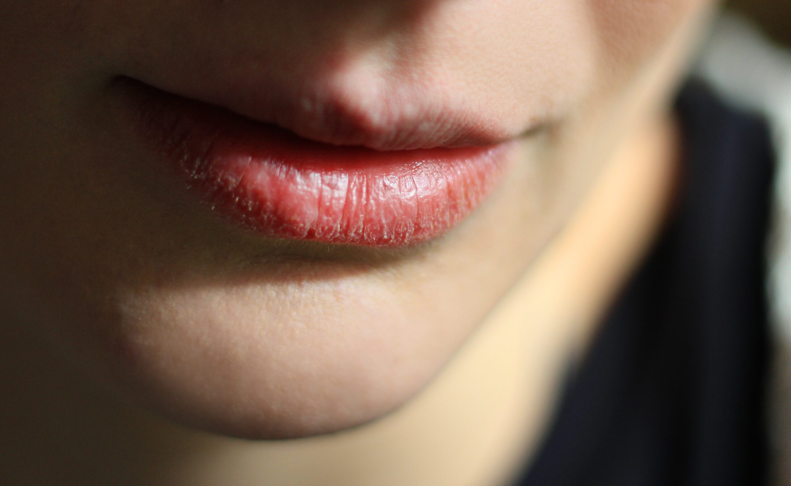 Read more about the article Trockene Lippen vermeiden – Tipps für geschmeidige Lippen